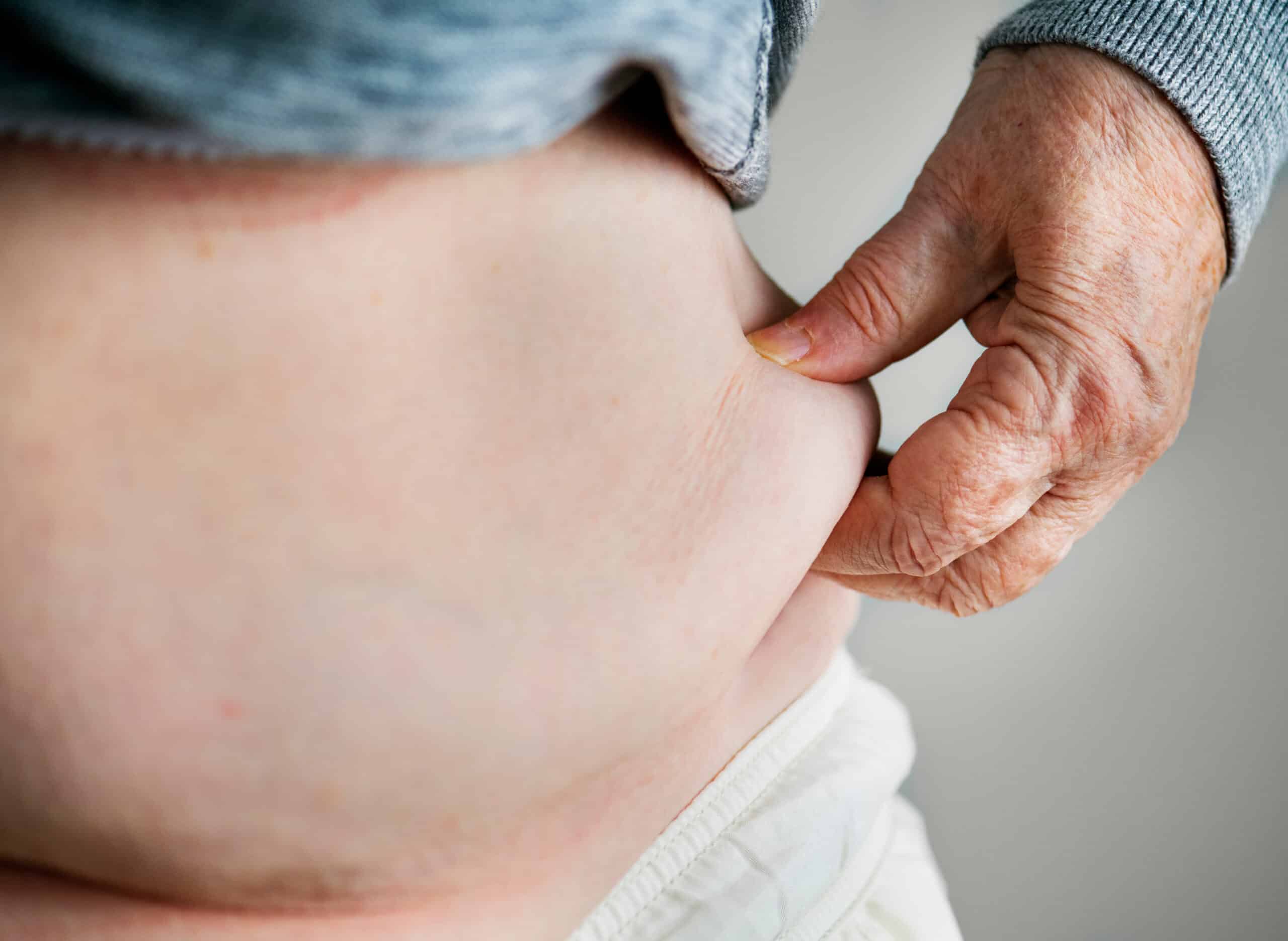 exercício para eliminar gordura sem correr
