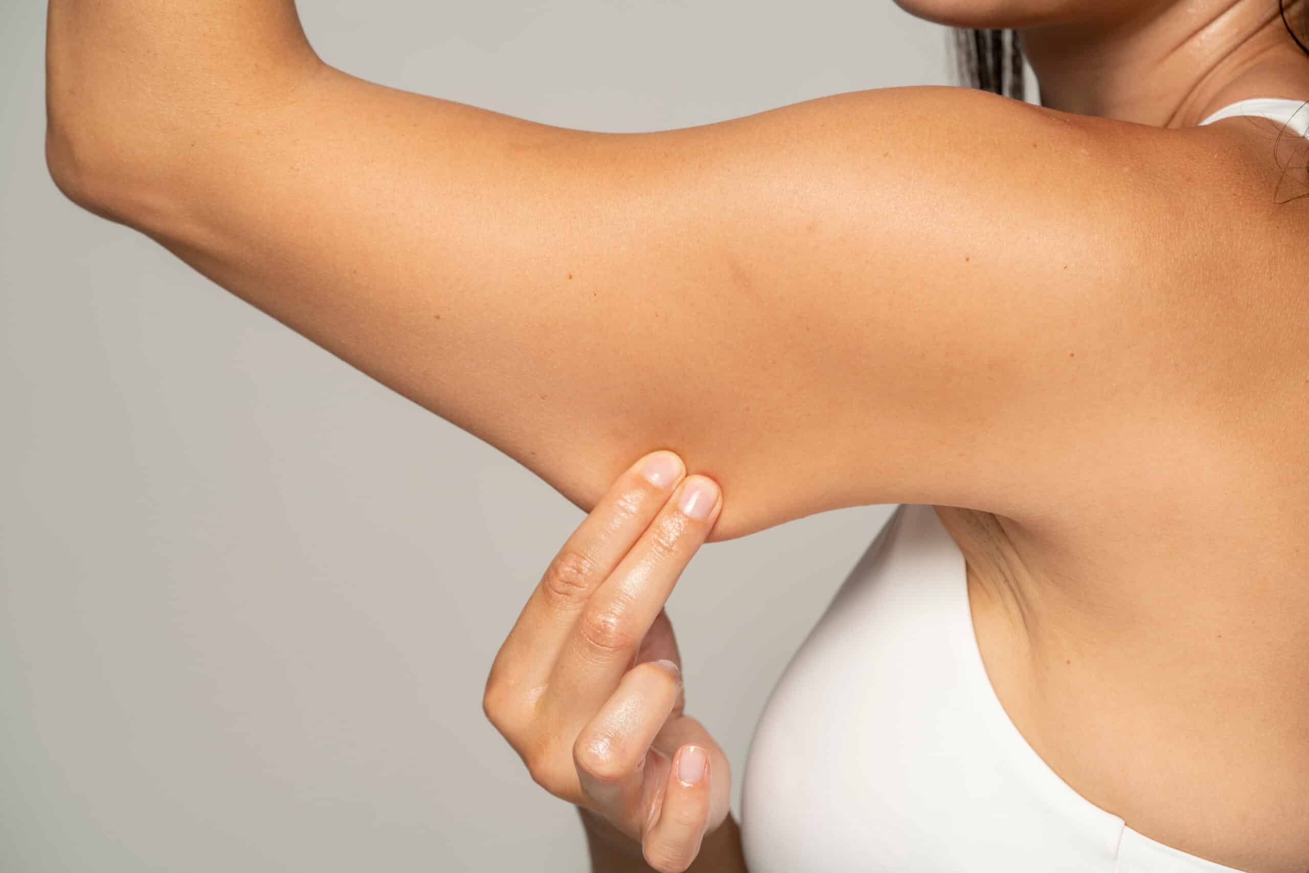 exercício para evitar braços flácidos